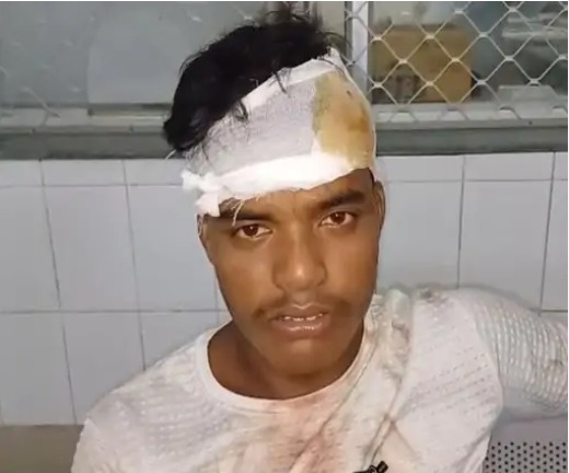 चाट दुकान पर मारपीट, 5 घायल 1 चाट दुकान पर मारपीट, 5 घायल 1