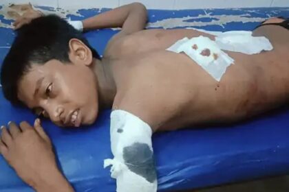 किशोर को चाकू मारकर मोबाइल और 5000 रुपए छीने 6